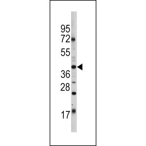 HL60 cell