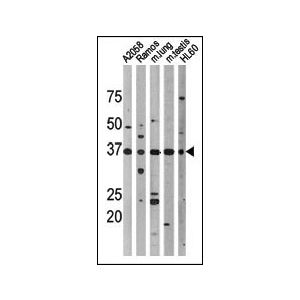 A2058, Ramos, mouse lung, mouse testis, , HL60 cell