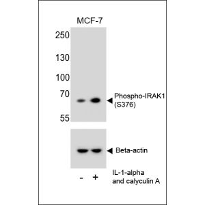 MCF-7 cells