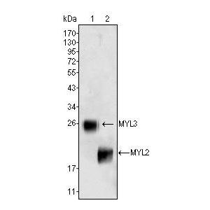 Rat fetal hearts