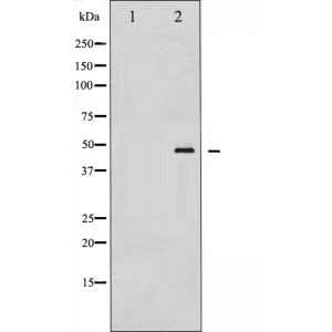 K562 whole cell lysates