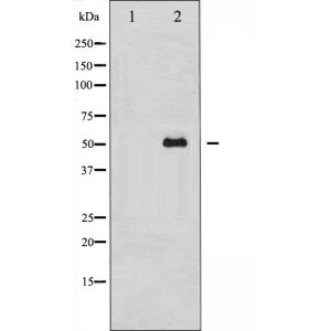 Mouse brain tissue lysates