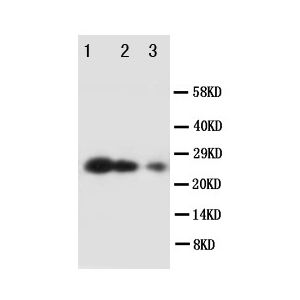 Human Recombinant Timp3