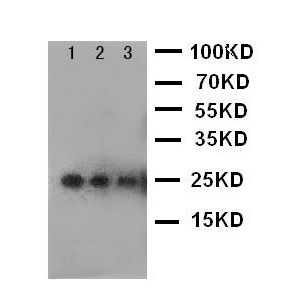 Human Recombinant VEGF