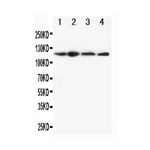 HEP-2, A549, U87, CEM