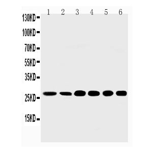 Rat Liver Tissue Lysate, Rat Intestine Tissue Lysate, HELA Cell Lysate, A549 Cell Lysate, SMMC Cell Lysate, MM231 Cell Lysate