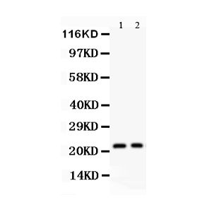 HELA Whole Cell Lysate, Human Placenta Tissue Lysate