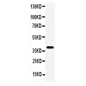 Recombinant Mouse Serum Amyloid P Protein