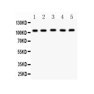 Mouse Testis Tissue Lysate, Mouse Skeletal Muscle Tissue Lysate, HELA Whole Cell Lysate, A549 Whole Cell Lysate, SMMC Whole Cell Lysate