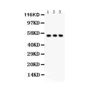 PANC Whole Cell Lysate, A549 Whole Cell Lysate, HT1080 Whole Cell Lysate