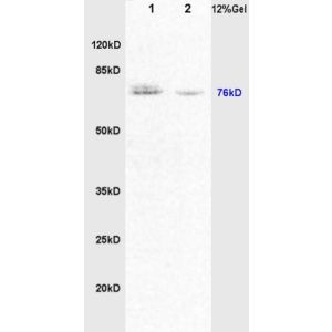 Lane 1: rat brain lysates Lane 2: rat lung lysates