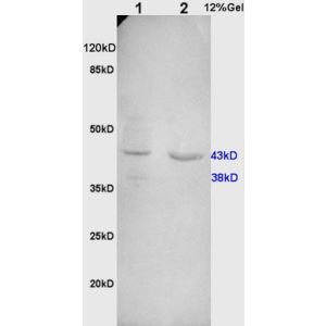 L1 rat kidney, L2 human colon carcinoma lysates