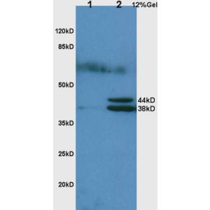 Western Blot