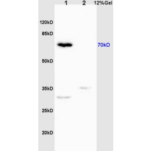 L1 mouse liver lysates L2 rat brain lysates