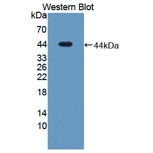 Latent-transforming growth factor beta-binding protein 1