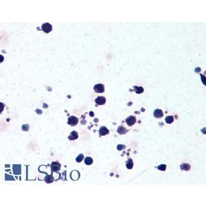 Immunohistochemistry