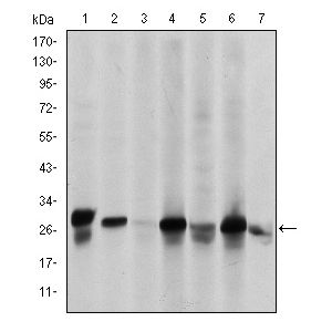 Hela (1), A549 (2), A431 (3) and HEK293 (4) cell lysate