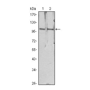 A549 (1), A431 (2), Hela (3), PANC-1 (4) and PC-3 (5) cell lysate