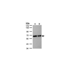 HepG2, MOLT4 