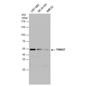 Various whole cell extracts