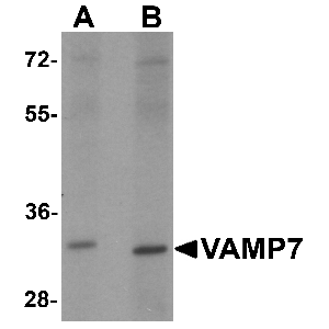 Lung tissue lysate