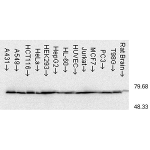 Western Blot