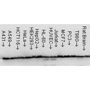 Western Blot