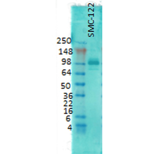 Western Blot