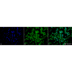 Western Blot