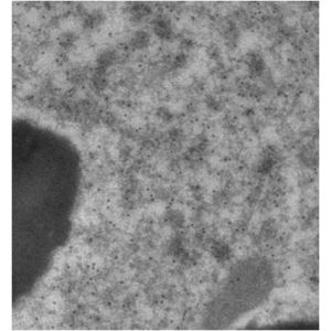 Immunogold labeling of RPE, in vivo injected with mCherry expressing vector;  