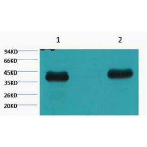 Western Blot