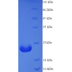 Protein SDS-PAGE