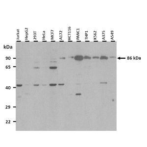 Western Blot