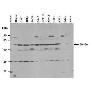 Western Blot