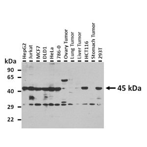 Western Blot