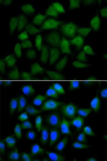 Alpha 1 Fetoprotein antibody