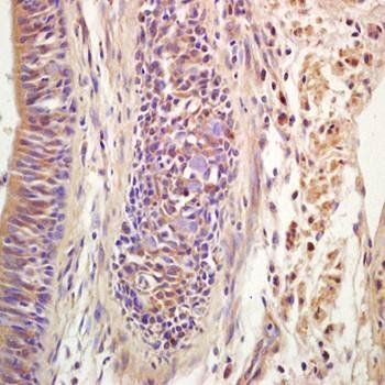 Ribonuclease Inhibitor antibody