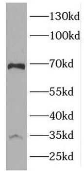 EMAP II antibody