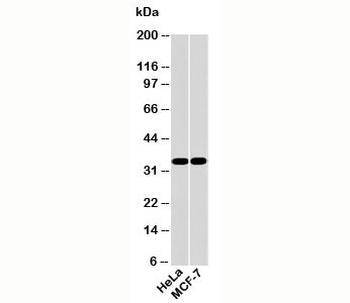 EMAP II Antibody