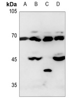 Alpha 1 Fetoprotein antibody