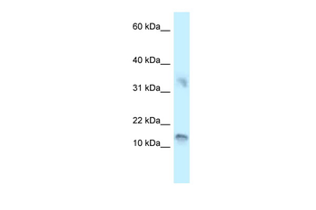 UTS2D antibody