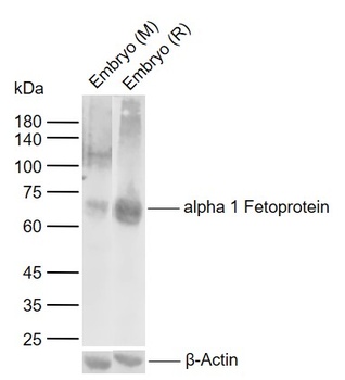 Alpha 1 Fetoprotein antibody