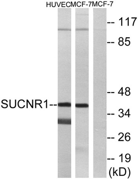 GPR91 antibody