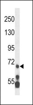 MLL5 antibody