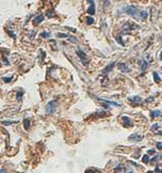 NLRC4 antibody