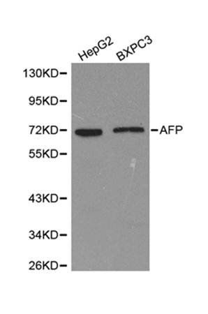 Alpha 1 Fetoprotein antibody