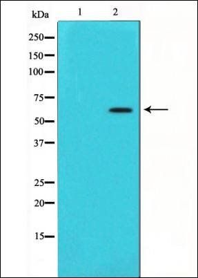 Alpha 1 Fetoprotein antibody