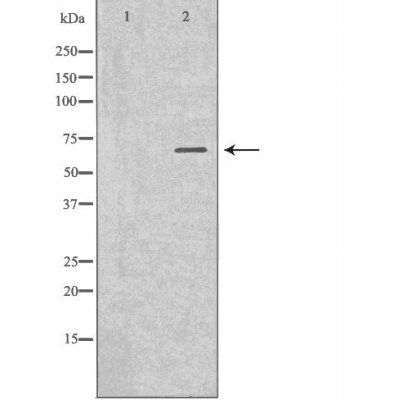 Alpha 1 Fetoprotein antibody