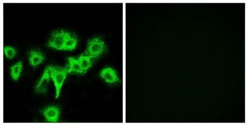 Collagen IV antibody