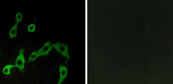 alpha 2a Adrenergic Receptor antibody